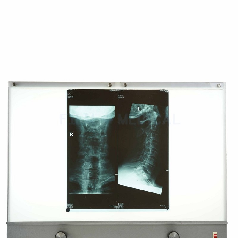 X_Ray Neck + Spine